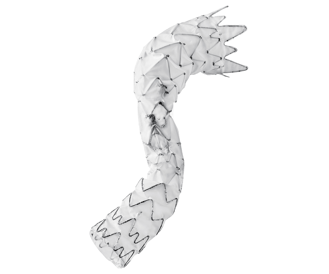 E-nside™ TAAA Çok Dallı Stent Greft Sistemi
