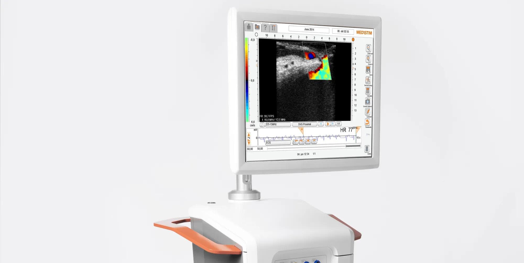 MiraQ Cardiac