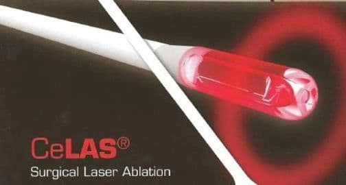 celas-laser